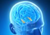 brain chip