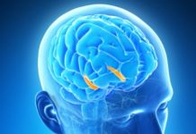 brain chip